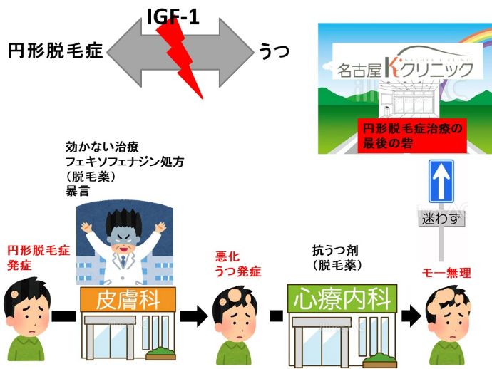 円形脱毛症　病院